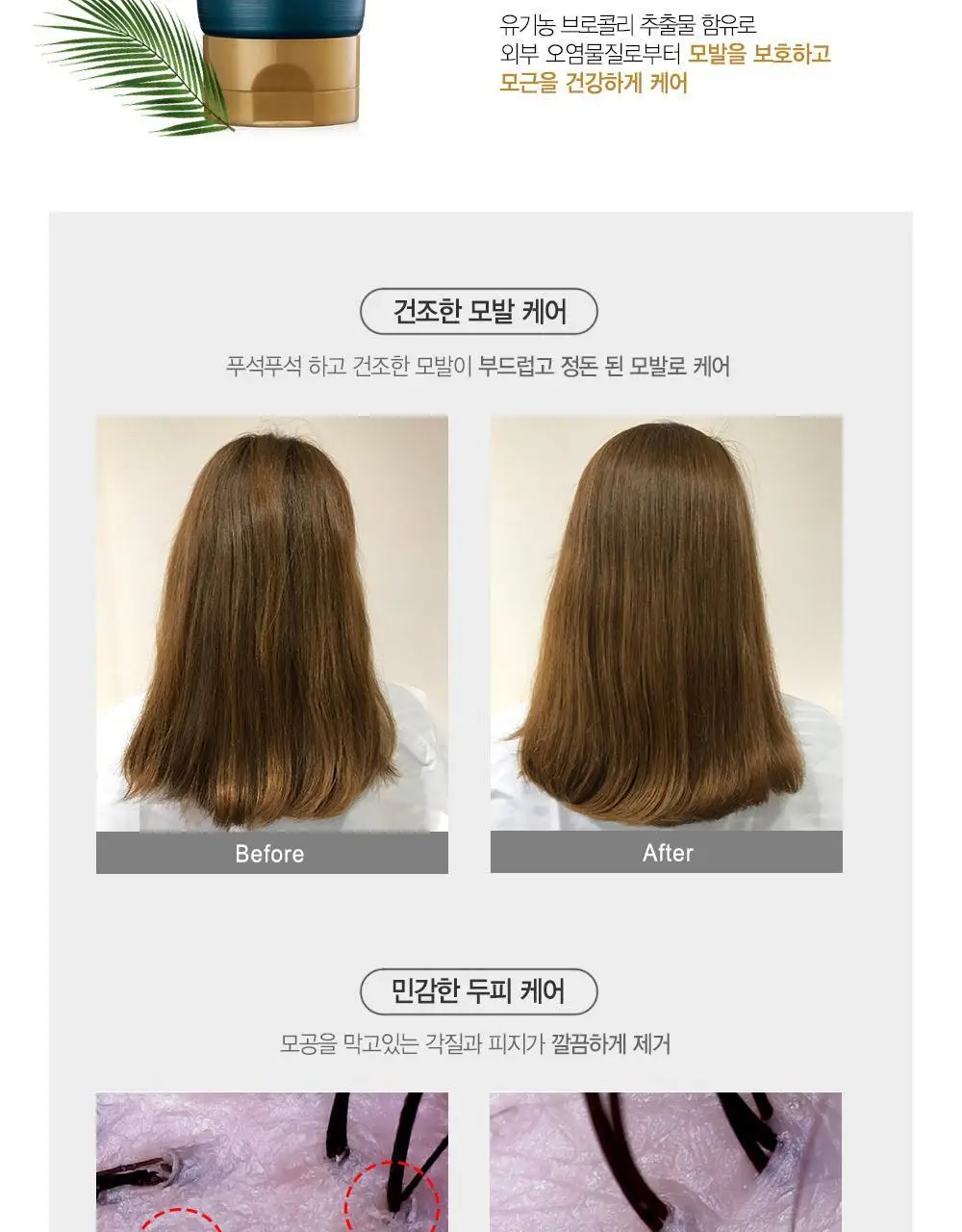 [갓생살다_탈모옴] 포레스트스토리 B7 안티 헤어 로스 헤어팩 200ml 상세페이지 11